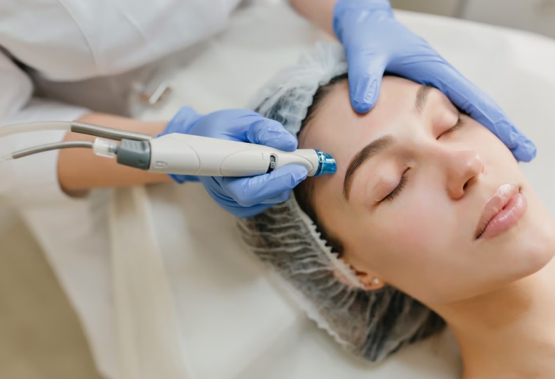 Microneedling Treatment in Jaipur