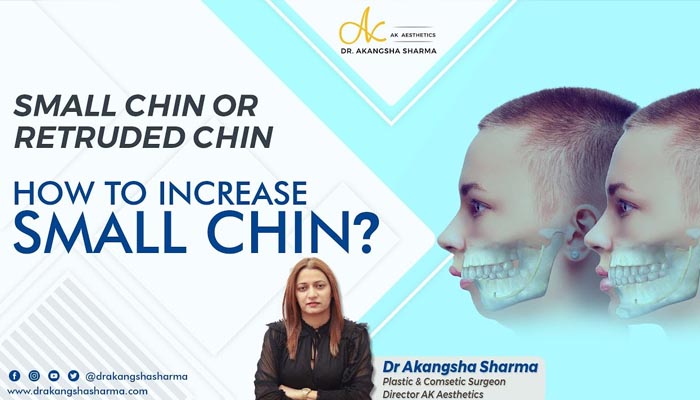 Small chin or Retruded Chin Surgery in Jaipur