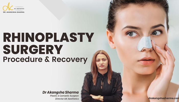 Rhinoplasty Surgery Procedure and Recovery 