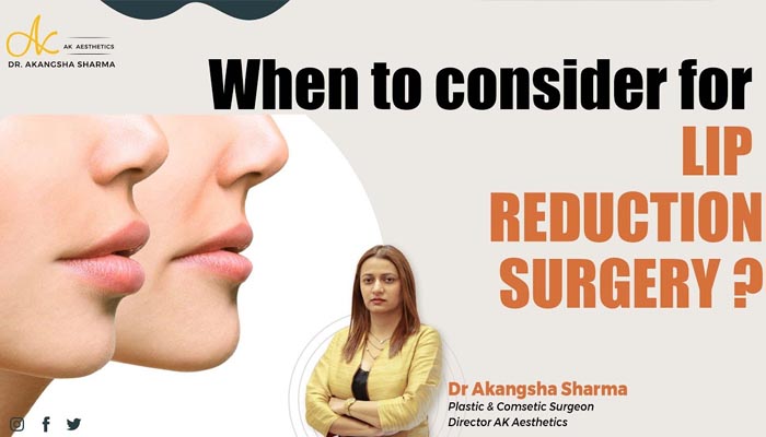 When to consider for lip reduction surgery? 