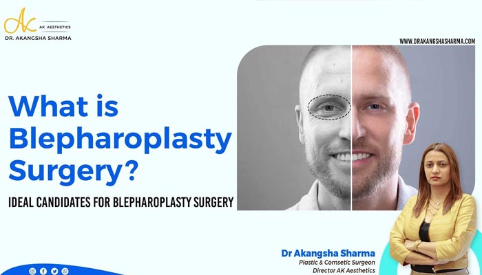 What is Blepharoplasty Surgery? | Ideal Candidates for Blepharoplasty Surgery | Dr Akangsha Sharma