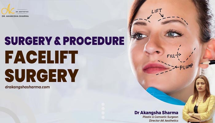 Surgery & procedure Facelift Surgery