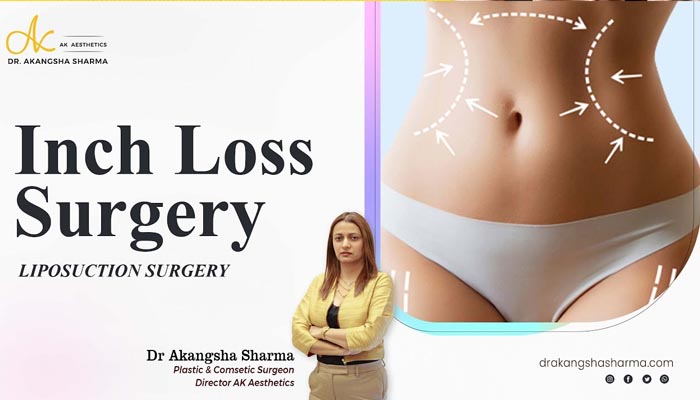 Liposuction surgery in Jaipur | inch loss surgery | Dr Akangsha Sharma