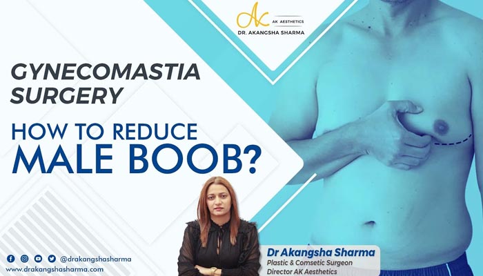 How to reduce male boob? | Gynecomastia Surgery in Jaipur