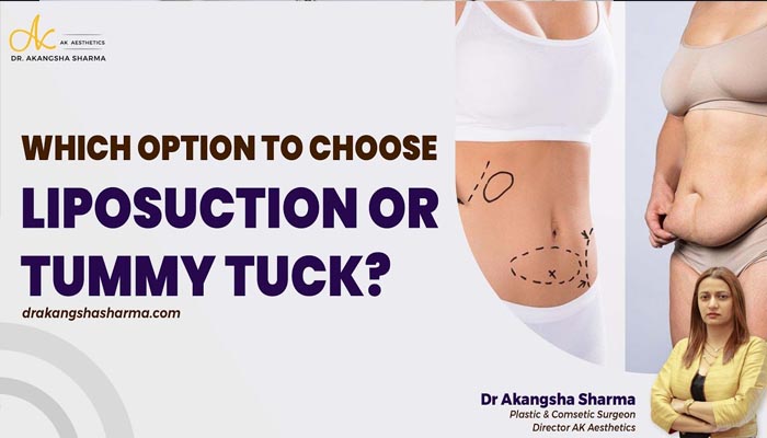 Which option to choose liposuction or tummy tuck? | Weight loss Surgery in Jaipur
