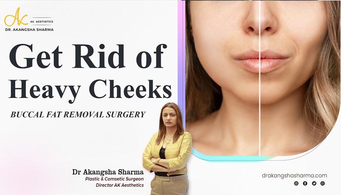 Get Rid of Heavy Cheeks | Buccal Fat Removal Surgery in Jaipur | Dr Akangsha Sharma