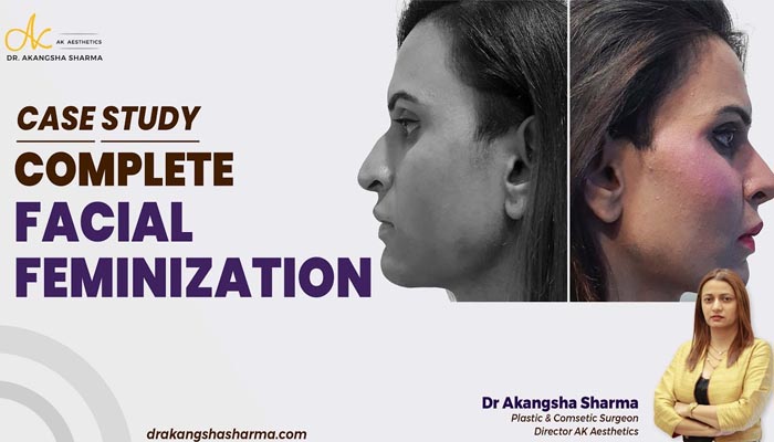 Complete Facial Feminization | Case Study | Face Surgery in Jaipur India | Dr Akangsha Sharma