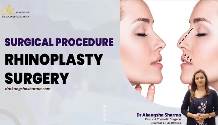 Surgical procedure of Rhinoplasty Surgery | Rhinoplasty Surgery in Jaipur | Dr Akangsha Sharma