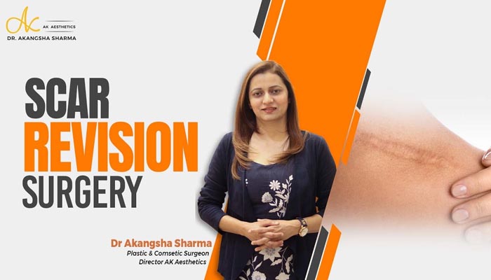 Scar revision surgery in Jaipur | Dr Akangsha Sharma