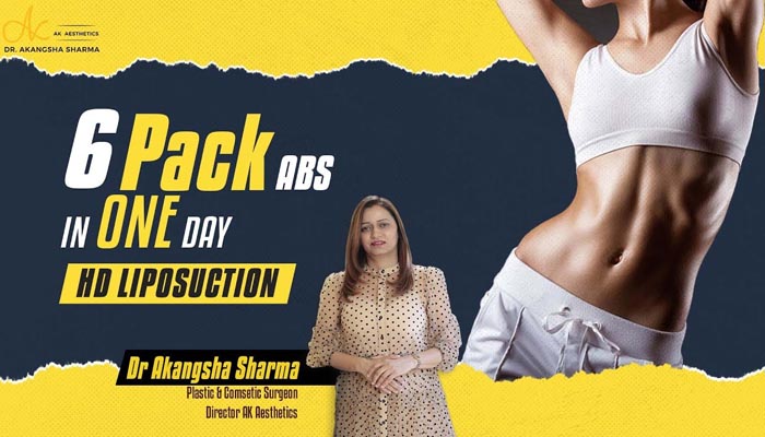 6 Pack abs in ONE day | HD(High-definition) Liposuction in Jaipur | Dr Akangsha Sharma
